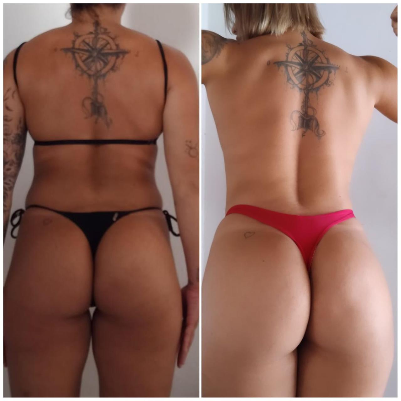 Pessoa 2 - Depois